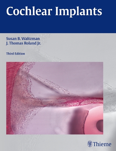Cochlear Implants Waltzman Hardback John Wiley & Sons 9781604069037