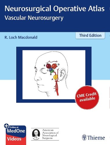 Neurosurgical Operative Atlas: Vascular Neurosurgery Macdonald Hardback
