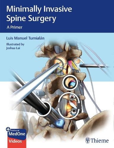 Minimally Invasive Spine Surgery – A Primer Tumialan Paperback MM – Thieme