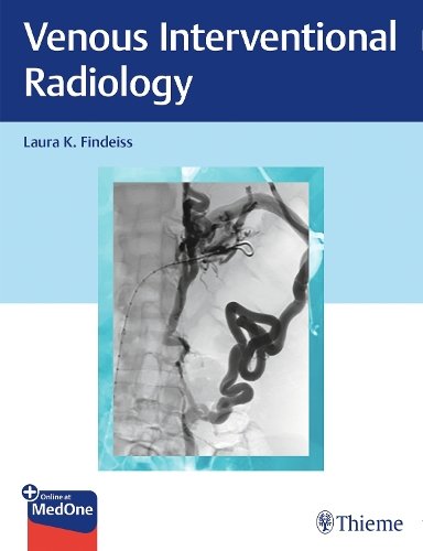 Venous Interventional Radiology Findeiss Hardback John Wiley & Sons