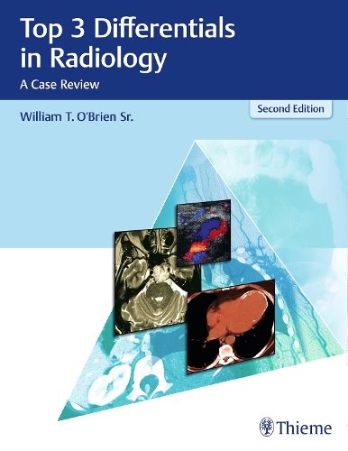 Top 3 Differentials in Radiology – A Case Review O`brien Hardback MM – Thieme