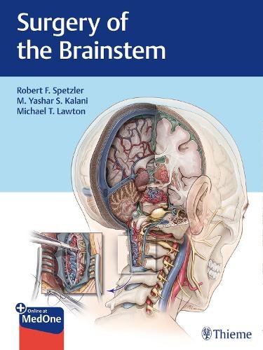 Surgery of the Brainstem Spetzler Kalani Lawton Paperback MM – Thieme