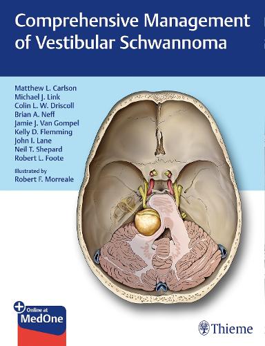 Comprehensive Management of Vestibular Schwannoma Carlson Driscoll Link Hardback