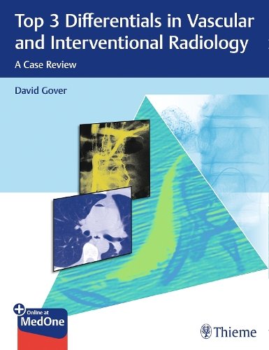 Top 3 Differentials in Vascular and Intervention – A Case Review Gover O`brien