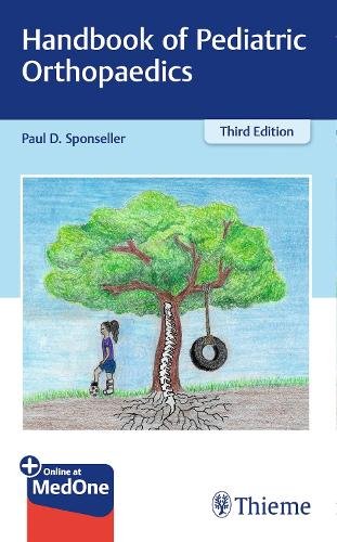 Handbook of Pediatric Orthopaedics Sponseller Paperback John Wiley & Sons