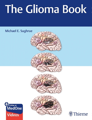 The Glioma Book Sughrue Paperback John Wiley & Sons 9781626234444