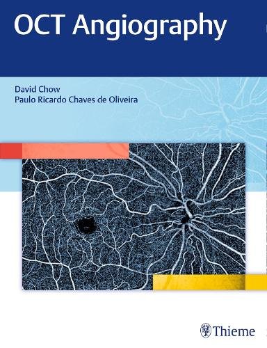 OCT Angiography Chow Hardback MM – Thieme 9781626234734