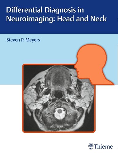 Differential Diagnosis in Neuroimaging: Head and Neck Meyers Hardback