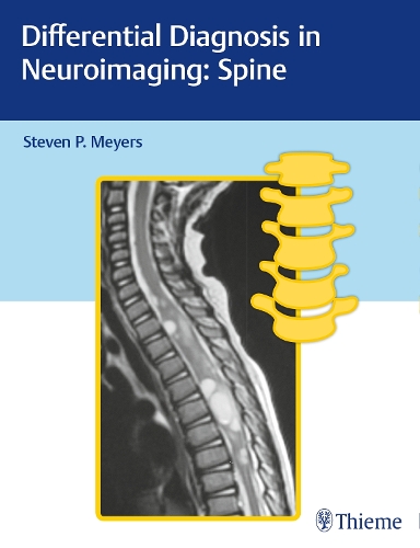 Differential Diagnosis in Neuroimaging: Spine Meyers Hardback John Wiley & Sons
