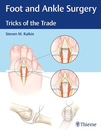 Foot and Ankle Surgery – Tricks of the Trade Raikin Hardback MM – Thieme