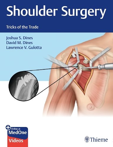 Shoulder Surgery – Tricks of the Trade Dines Dines Gulotta Hardback