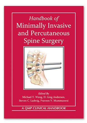 Handbook of Minimally Invasive and Percutaneous Spine Surgery Wang Anderson