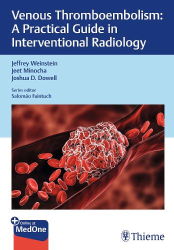 Practical Guides in Interventional Radiology – Venous Thromboembolism Weinstein