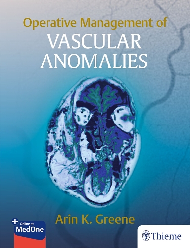 Operative Management of Vascular Anomalies Greene Hardback MM – Thieme