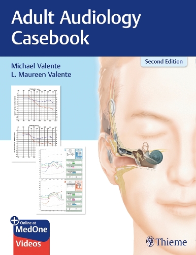 Adult Audiology Casebook Valente Valente Paperback John Wiley & Sons
