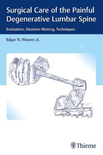 Surgical Care of the Painful Degenerative Lumbar – Evaluation, Decision–Making,…