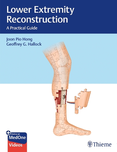 Lower Extremity Reconstruction Hong Paperback John Wiley & Sons 9781626238084