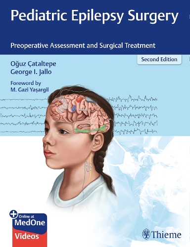 Pediatric Epilepsy Surgery – Preoperative Assessment and Surgical Treatment