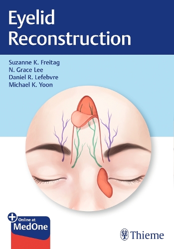 Eyelid Reconstruction Freitag Paperback John Wiley & Sons 9781626238237