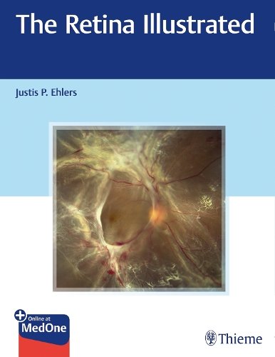 The Retina Illustrated Ehlers Paperback MM – Thieme 9781626238312