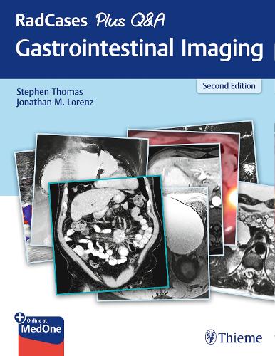 RadCases Plus Q&A Gastrointestinal Imaging Thomas Lorenz Paperback 9781626238688