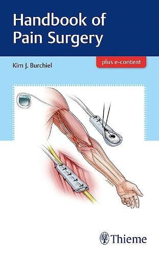 Handbook of Pain Surgery Burchiel Paperback MM – Thieme 9781626238718