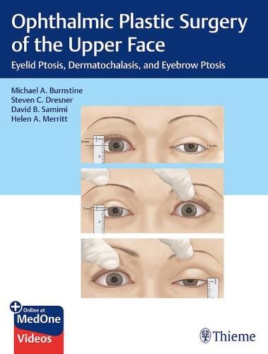 Ophthalmic Plastic Surgery of the Upper Face – Eyelid Ptosis, Dermatochalasis, …