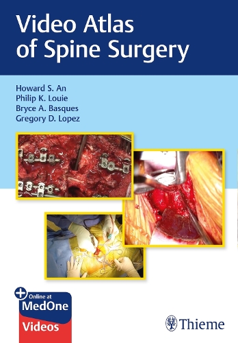 Video Atlas of Spine Surgery An Louie Basques Lopez Paperback John Wiley & Sons