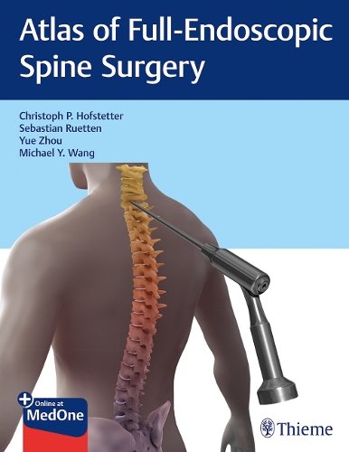 Atlas of Full–Endoscopic Spine Surgery Hofstetter Ruetten Zhou Wang Hardback