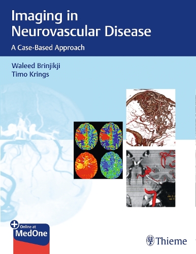 Imaging in Neurovascular Disease – A Case–Based Approach Brinjikji Krings