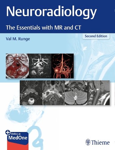 Neuroradiology Runge Paperback MM – Thieme 9781684201532