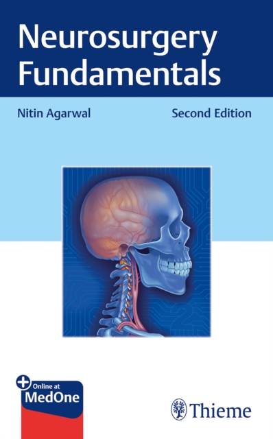 Neurosurgery Fundamentals Agarwal Hardback John Wiley & Sons 9781684204984