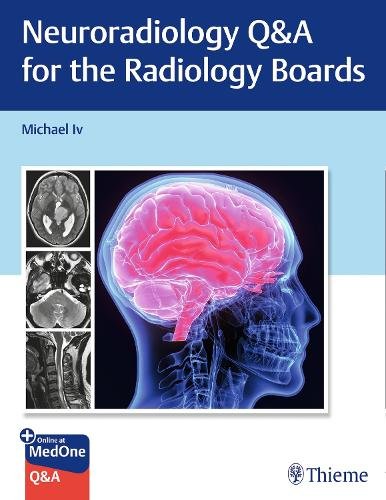 Neuroradiology Q&A for the Radiology Boards Iv Paperback John Wiley & Sons