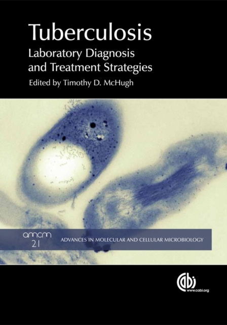 Tuberculosis – Laboratory Diagnosis and Treatment Strategies Ramsay Mchugh Ling