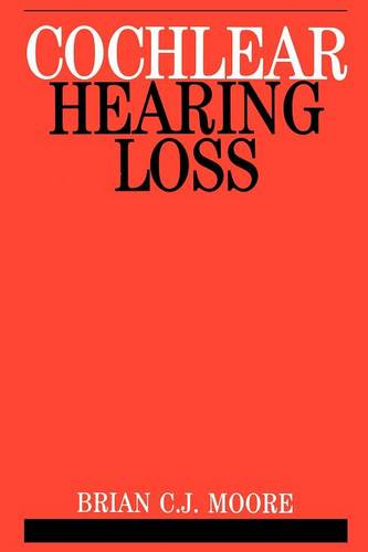 Cochlear Hearing Loss Moore Paperback Wiley–Blackwell 9781861560919