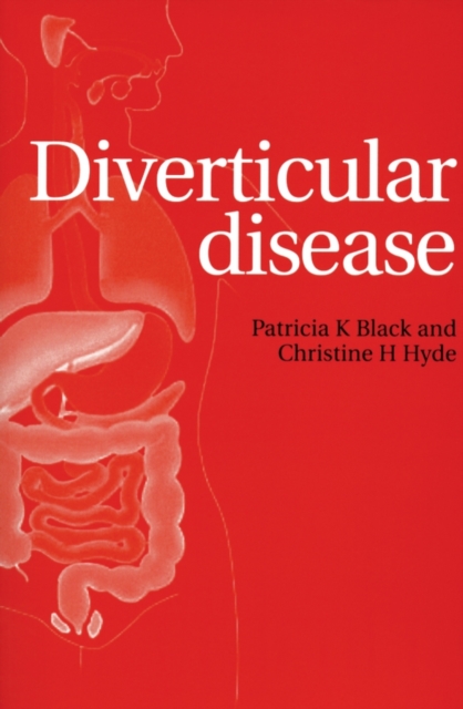 Diverticular Disease Black Paperback Wiley–Blackwell 9781861564467