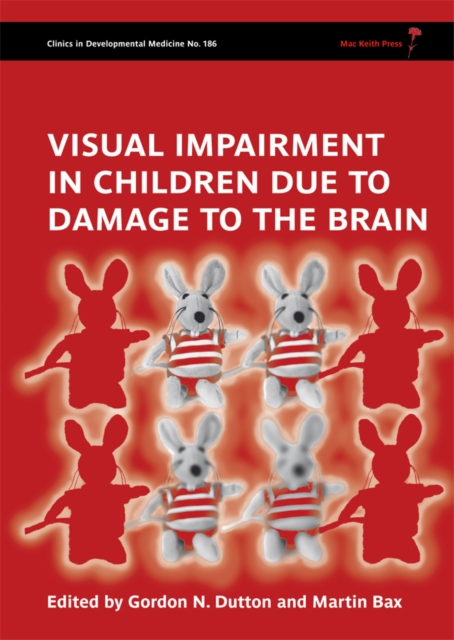 Visual Impairment in Children Due to Damage to the Brain Dutton Hardback