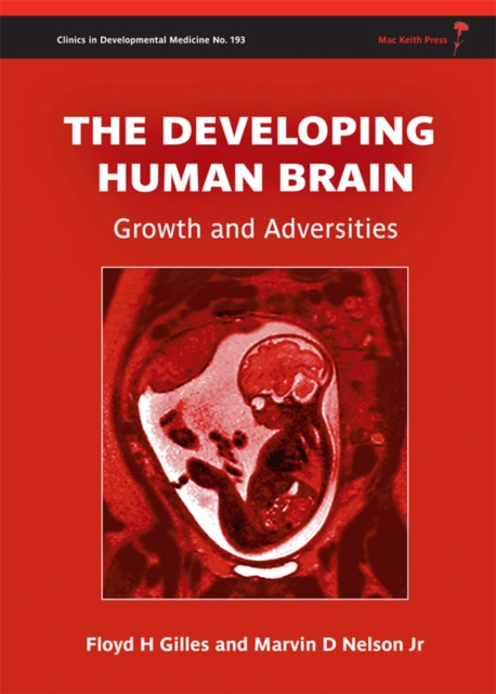The Developing Human Brain Growth and Adversities Gilles Nelson Hardback