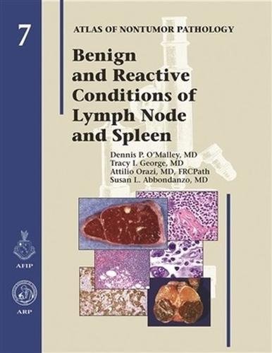 Benign and Reactive Conditions of Lymph Node and Spleen O′malley George Orazi