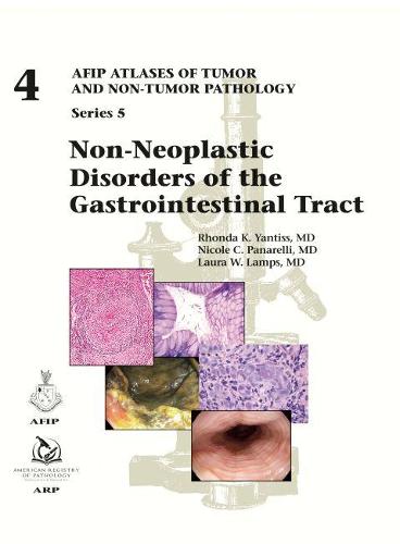 Non–Neoplastic Disorders of the Gastrointestinal Tract Yantiss Panarelli Lamps