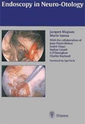 Endoscopy in Neuro–Otology and Skull Base Surgery (AT) Magnan Magnan Md Sanna