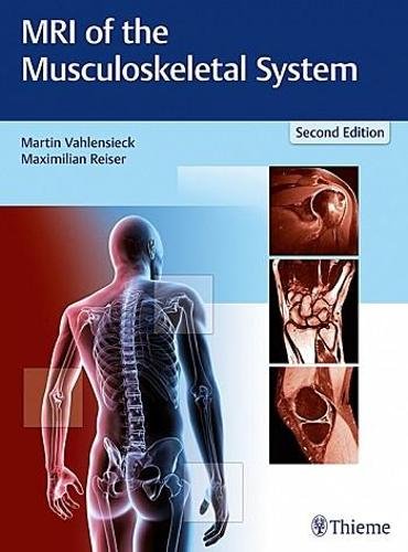 MRI of the Musculoskeletal System Vahlensieck Reiser Genant Hardback MM – Thieme
