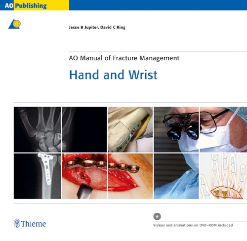 AO Manual of Fracture Management – Hand and Wrist Jupiter Ring Hardback