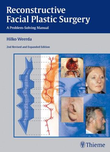 Reconstructive Facial Plastic Surgery – A Problem–Solving Manual Weerda Hardback