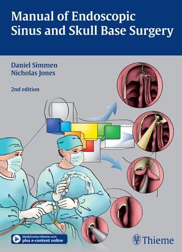 Manual of Endoscopic Sinus and Skull Base Surgery Simmen Jones Balakrishnan