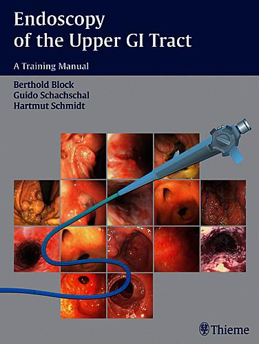 Endoscopy of the Upper GI Tract – A Training Manual Block Schachschal Schmidt