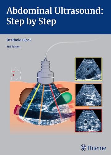 Abdominal Ultrasound: Step by Step Block Paperback John Wiley & Sons