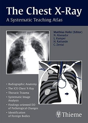 The Chest X–Ray – A Systematic Teaching Atlas Hofer Paperback John Wiley & Sons
