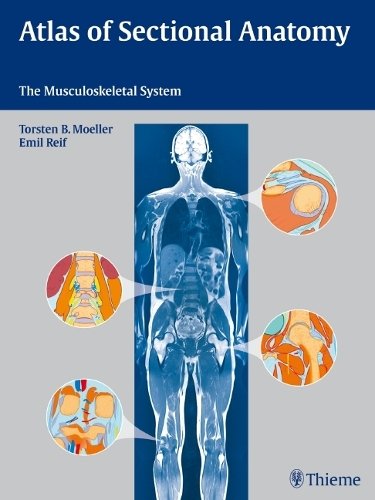 Atlas of Sectional Anatomy – The Musculoskeletal System Möller Reif Hardback