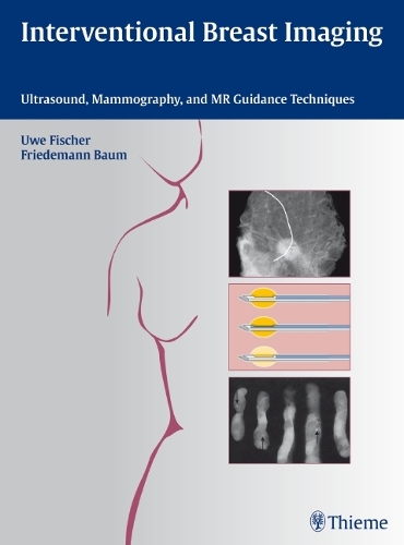 Interventional Breast Imaging – Ultrasound, Mammography, and MR Guidance Techni…
